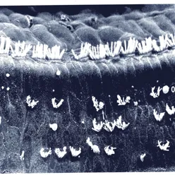 Et svart-hvitt-bilde av ødelagte hårceller. Bildet er tatt i mikroskop.