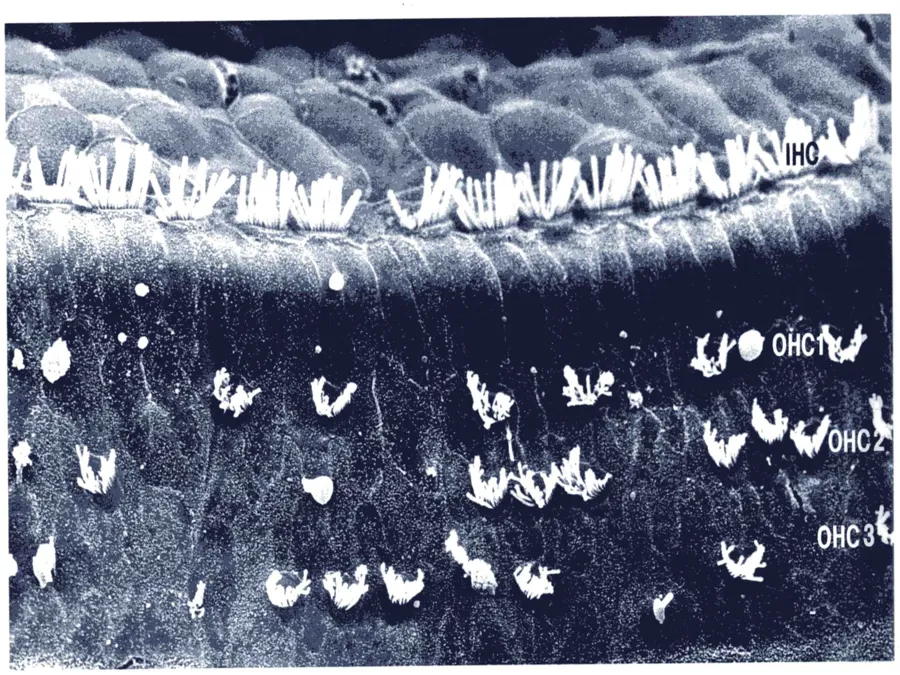 Et svart-hvitt-bilde av ødelagte hårceller, .