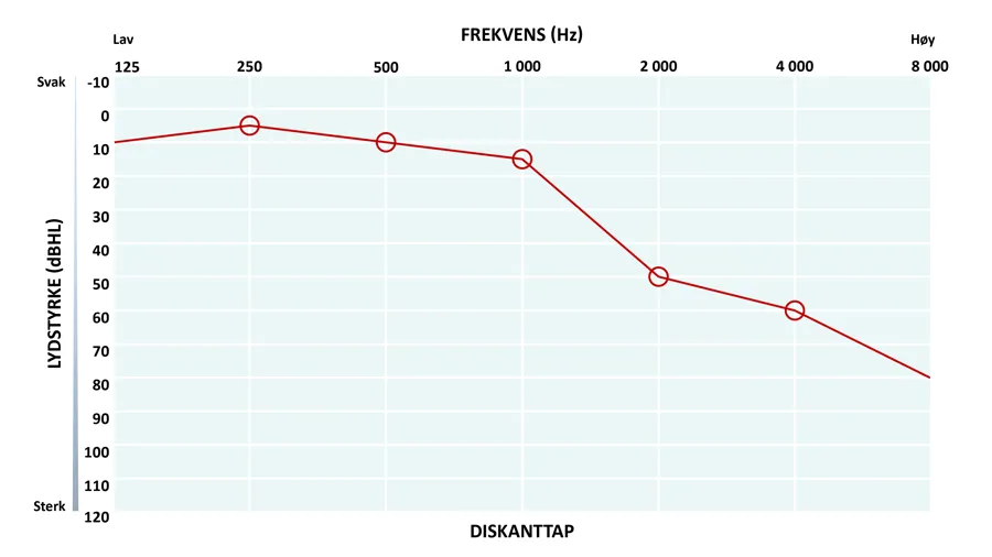 Audiogram som viser diskanttap.