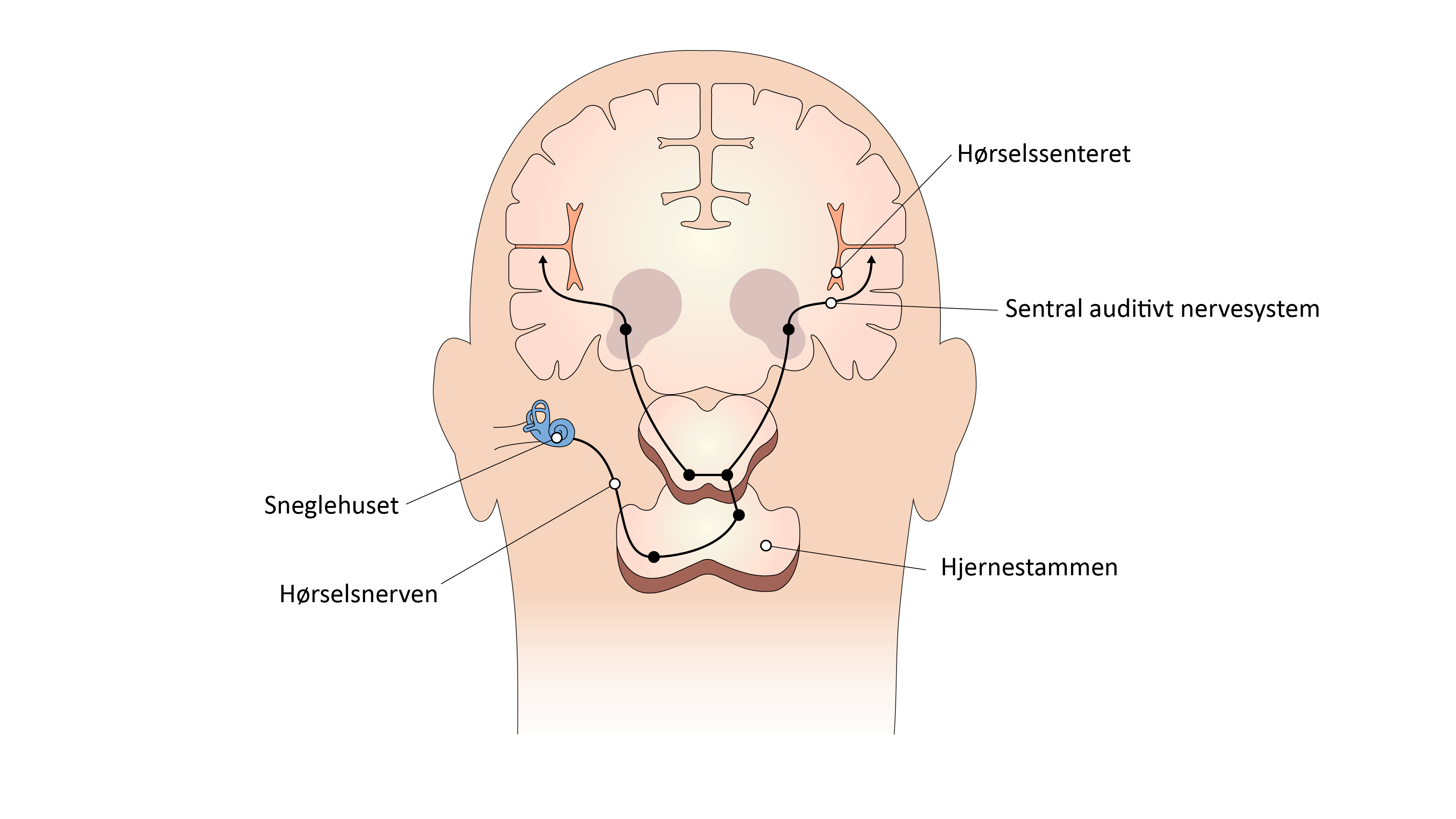 Illustrasjon av hjernen med streker og tekst som forklarer de hørselsrelaterte delene.